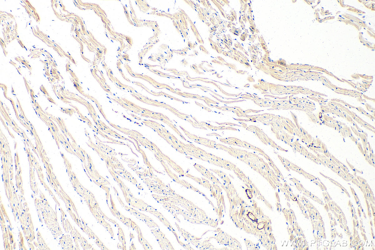 Immunohistochemistry (IHC) staining of mouse heart tissue using transgelin/SM22 Polyclonal antibody (10493-1-AP)