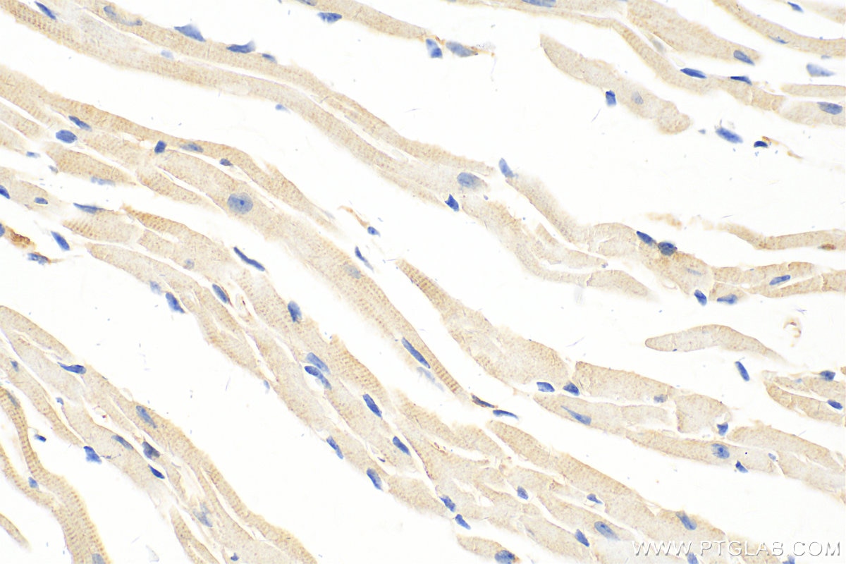 Immunohistochemistry (IHC) staining of mouse heart tissue using transgelin/SM22 Polyclonal antibody (10493-1-AP)
