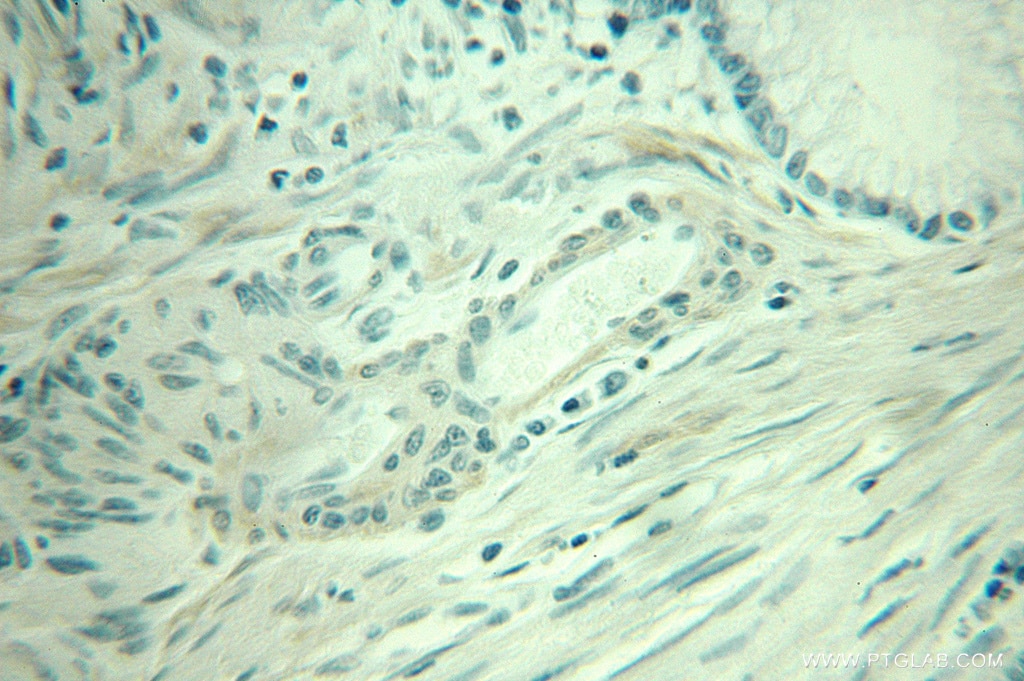 transgelin/SM22