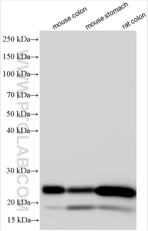 Western Blot (WB) analysis of various lysates using transgelin/SM22 Polyclonal antibody (10493-1-AP)