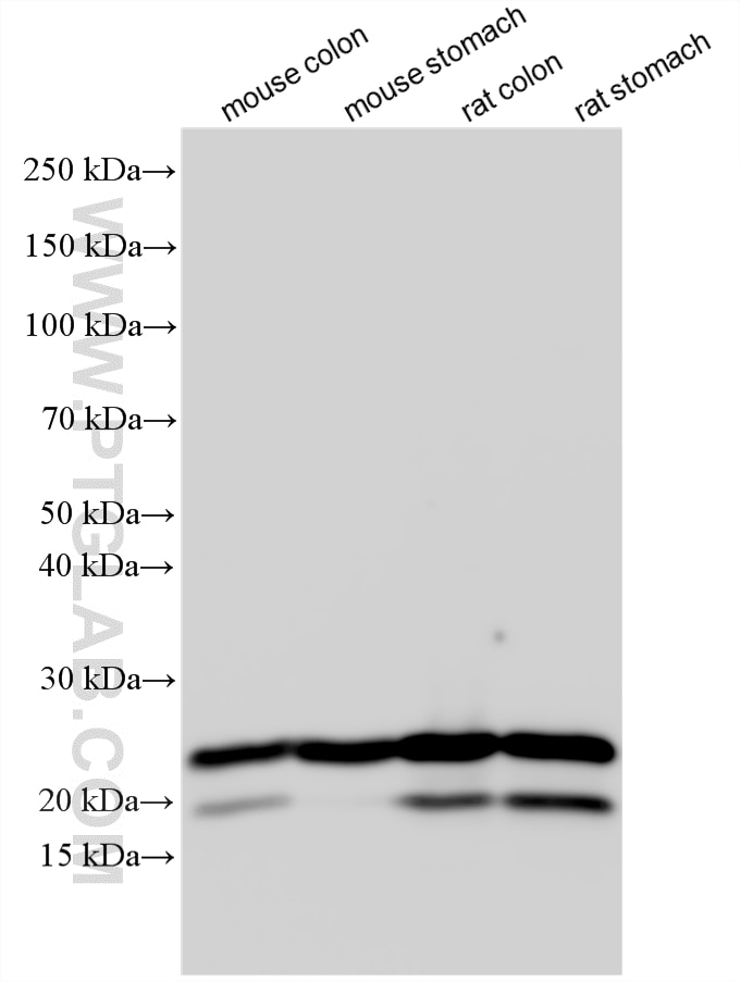Various lysates were subjected to SDS PAGE followed by western blot with 10493-1-AP (transgelin/SM22 antibody) at dilution of 1:50000 incubated at room temperature for 1.5 hours. Western Blot (WB) analysis of various lysates using transgelin/SM22 Polyclonal antibody (10493-1-AP)
