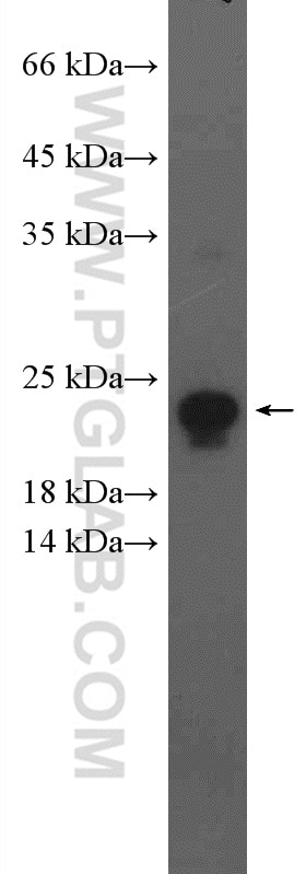 Western Blot (WB) analysis of Caco-2 cells using transgelin/SM22 Polyclonal antibody (10493-1-AP)