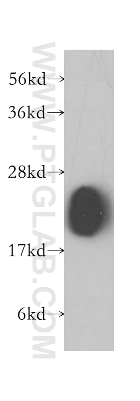 Western Blot (WB) analysis of human colon tissue using transgelin/SM22 Polyclonal antibody (10493-1-AP)