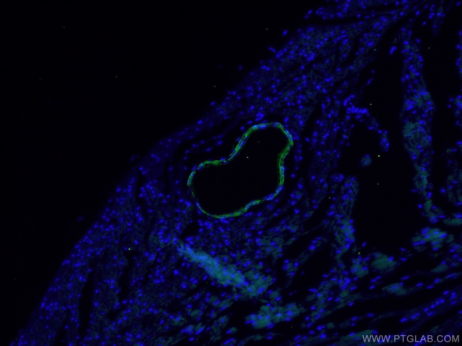 Immunofluorescence (IF) / fluorescent staining of mouse heart tissue using transgelin/SM22 Monoclonal antibody (60213-1-Ig)