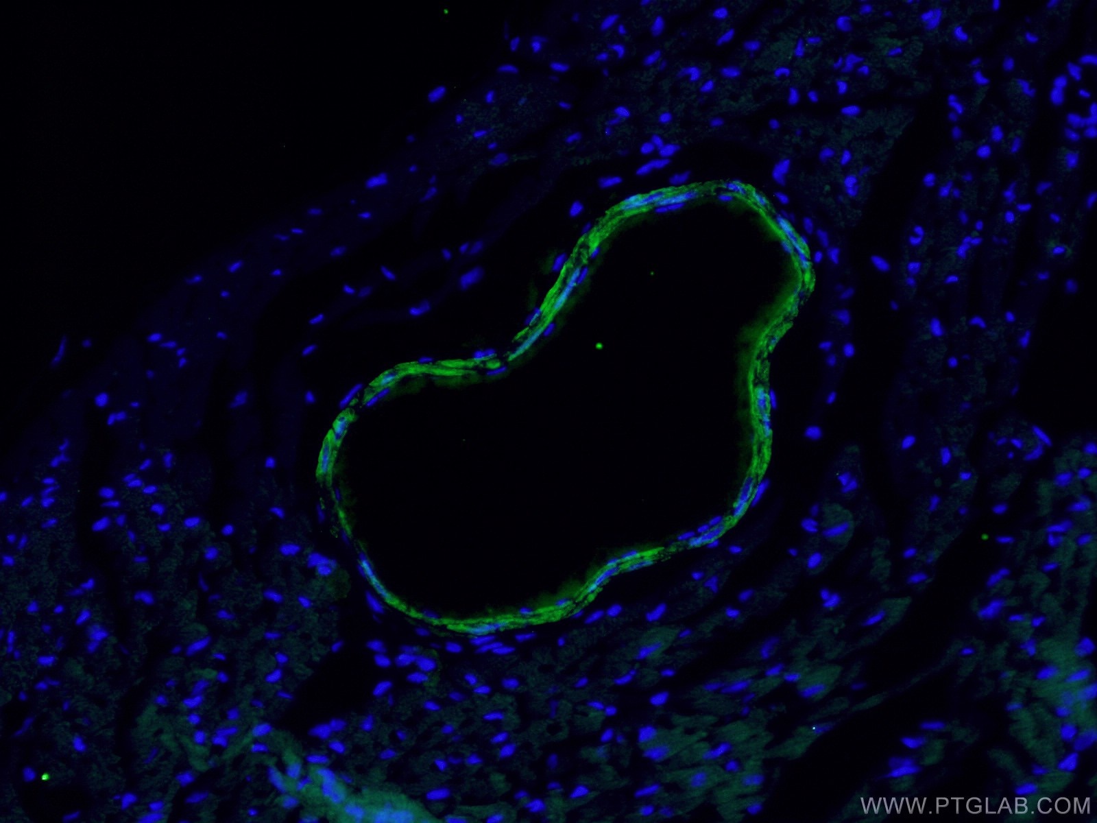 IF Staining of mouse heart using 60213-1-Ig