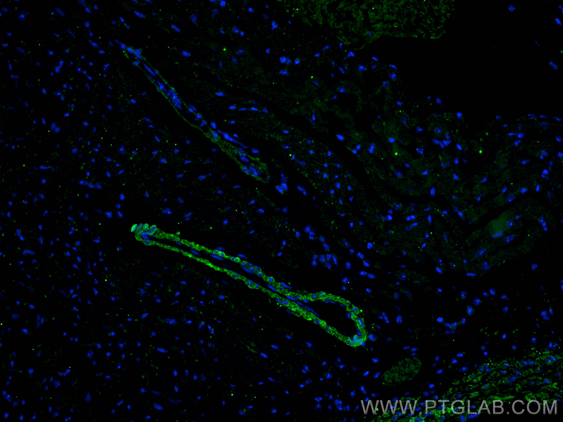 Immunofluorescence (IF) / fluorescent staining of mouse heart tissue using transgelin/SM22 Monoclonal antibody (60213-1-Ig)