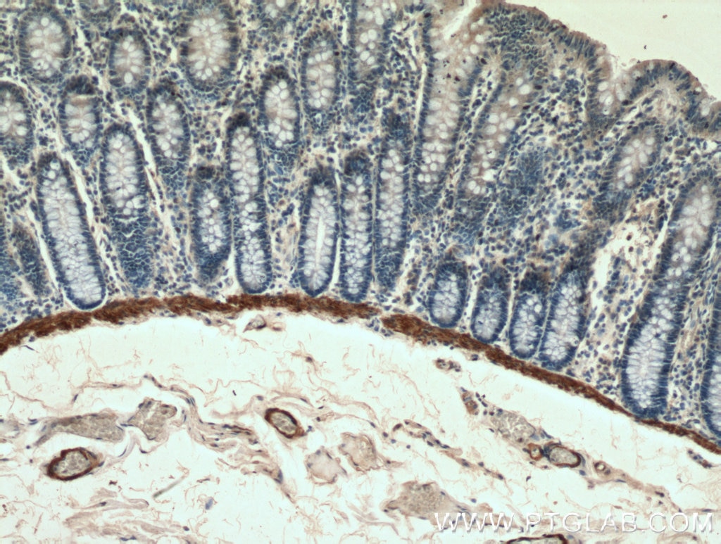 Immunohistochemistry (IHC) staining of human colon tissue using transgelin/SM22 Monoclonal antibody (60213-1-Ig)