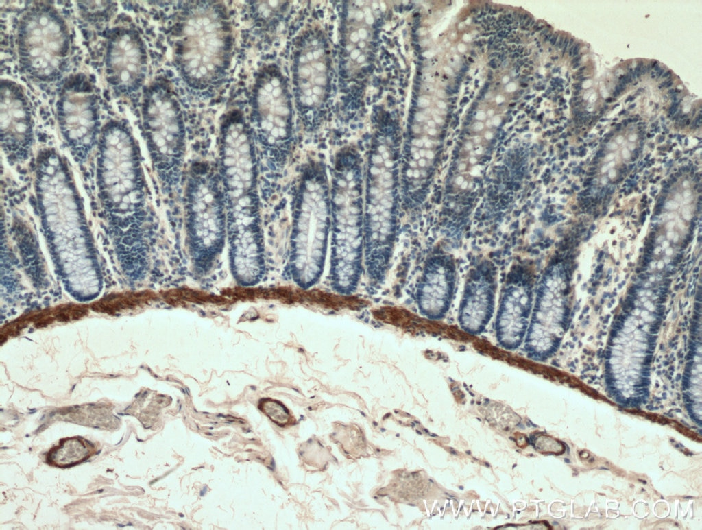 IHC staining of human colon using 60213-1-Ig