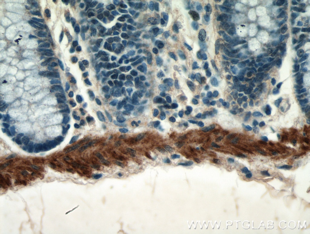 Immunohistochemistry (IHC) staining of human colon tissue using transgelin/SM22 Monoclonal antibody (60213-1-Ig)