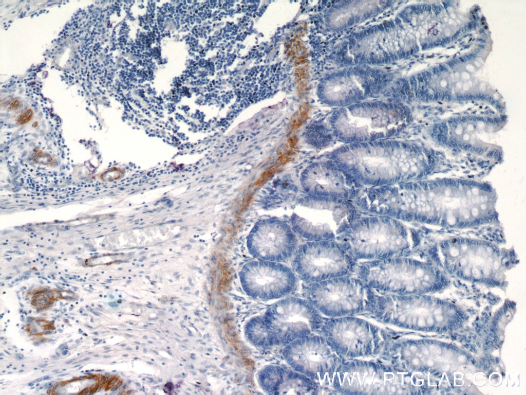 Immunohistochemistry (IHC) staining of human colon tissue using transgelin/SM22 Monoclonal antibody (60213-1-Ig)