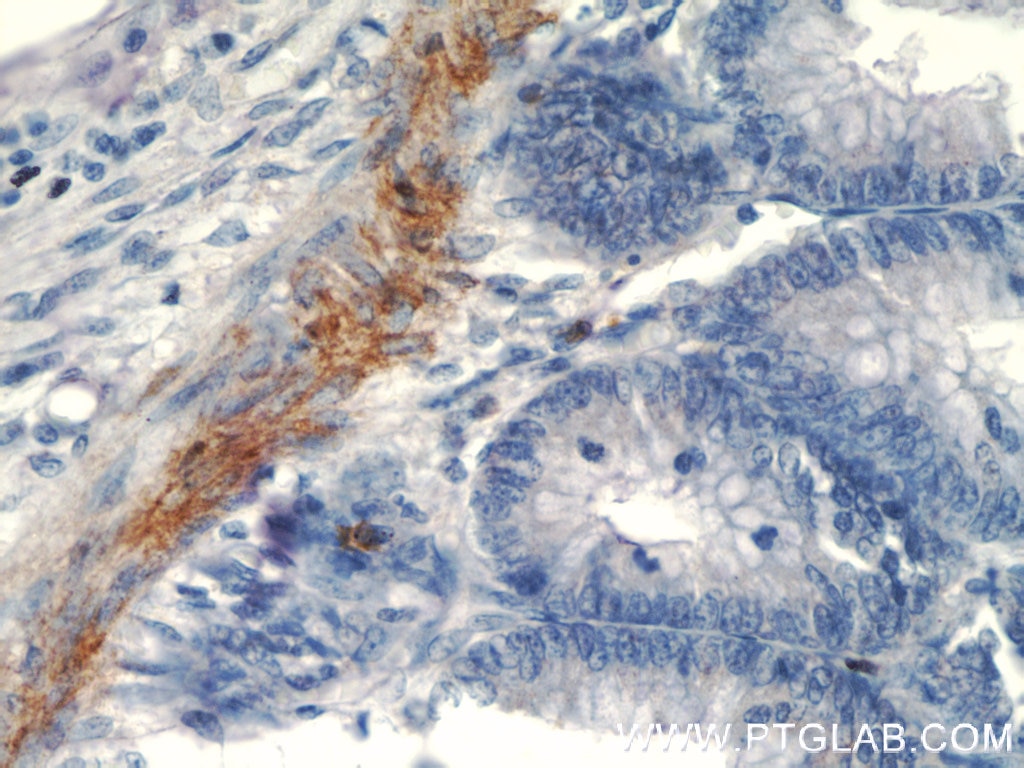 Immunohistochemistry (IHC) staining of human colon tissue using transgelin/SM22 Monoclonal antibody (60213-1-Ig)