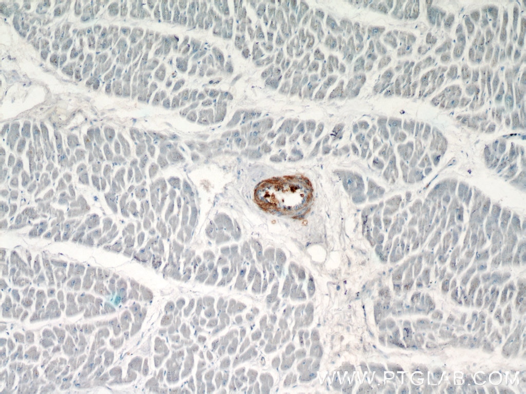 Immunohistochemistry (IHC) staining of human heart tissue using transgelin/SM22 Monoclonal antibody (60213-1-Ig)