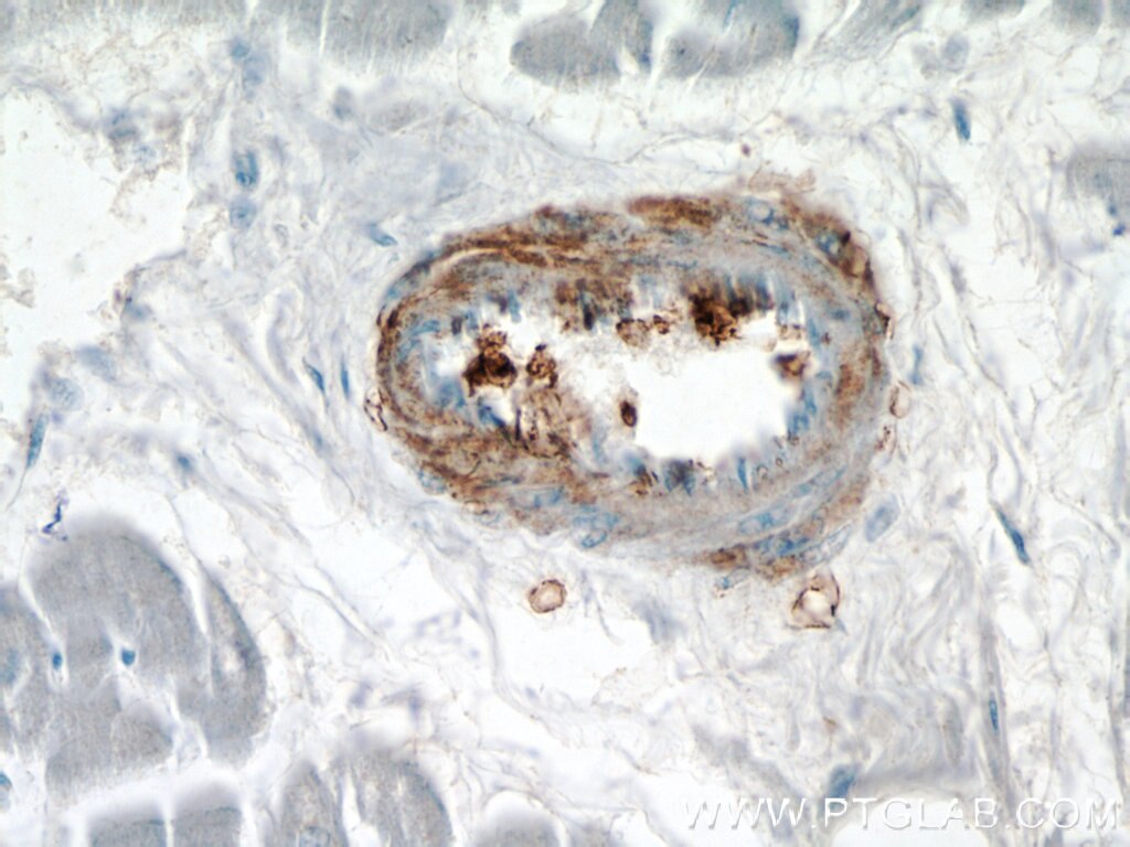 IHC staining of human heart using 60213-1-Ig