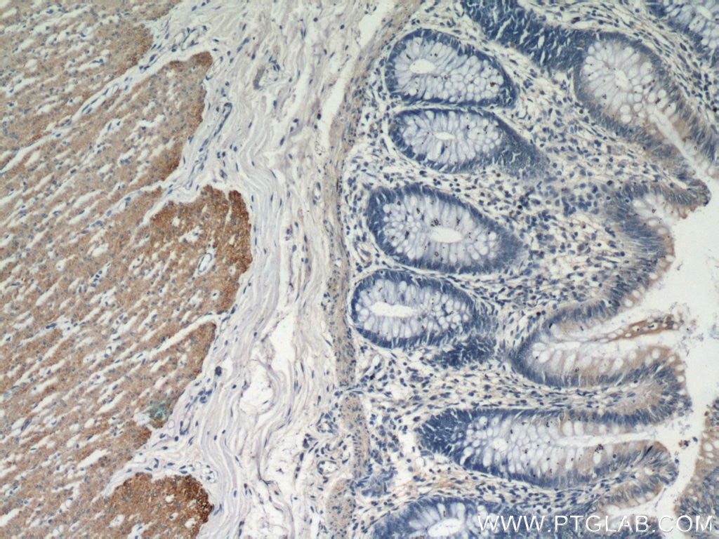 transgelin/SM22 Monoclonal antibody