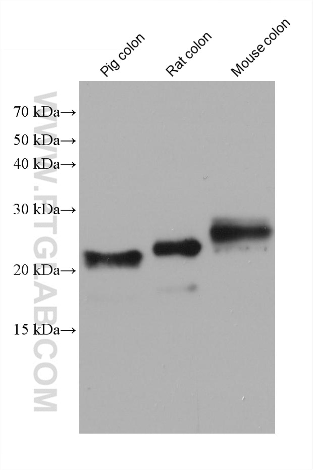 Western Blot (WB) analysis of various lysates using transgelin/SM22 Monoclonal antibody (60213-1-Ig)