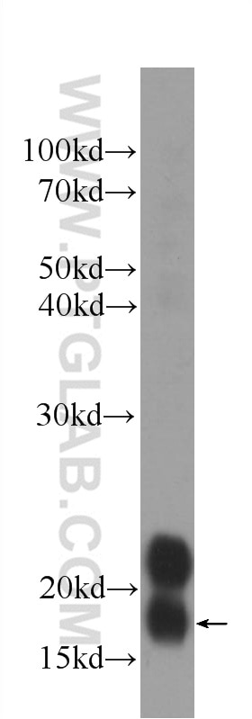 Western Blot (WB) analysis of human stomach tissue using transgelin/SM22 Monoclonal antibody (60213-1-Ig)