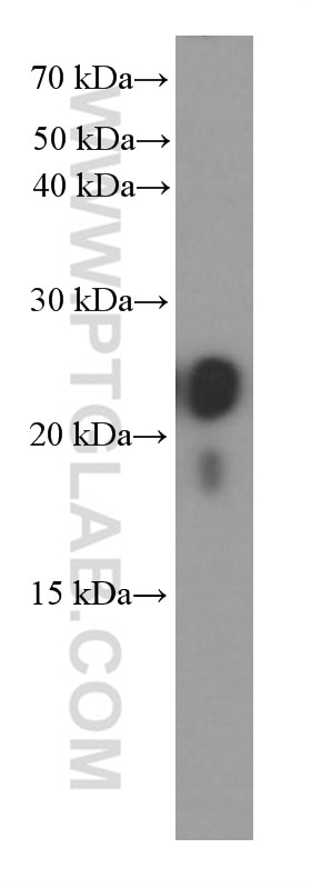 Western Blot (WB) analysis of human colon tissue using transgelin/SM22 Monoclonal antibody (60213-1-Ig)