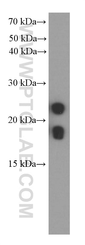 Western Blot (WB) analysis of rat colon tissue using transgelin/SM22 Monoclonal antibody (60213-1-Ig)