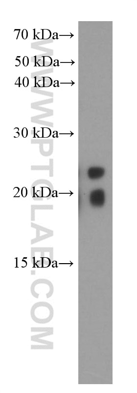 Western Blot (WB) analysis of rat stomach tissue using transgelin/SM22 Monoclonal antibody (60213-1-Ig)