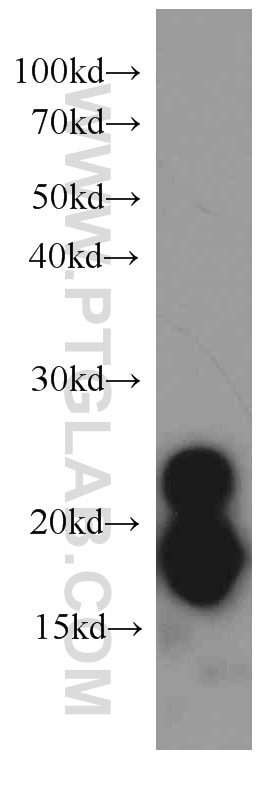 Western Blot (WB) analysis of human colon tissue using transgelin/SM22 Monoclonal antibody (60213-1-Ig)
