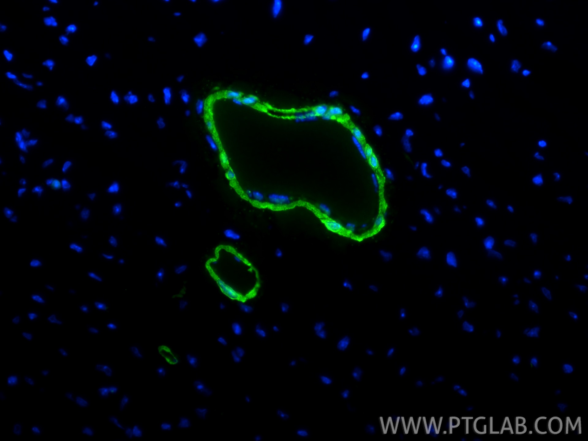 Immunofluorescence (IF) / fluorescent staining of mouse heart tissue using Multi-rAb® TAGLN Multi-Recombinant antibody (RMX00045)