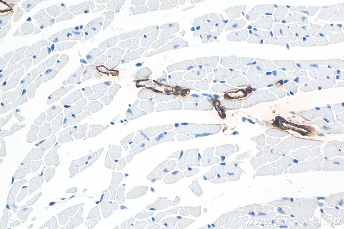 Immunohistochemistry (IHC) staining of mouse heart tissue using Multi-rAb® TAGLN Multi-Recombinant antibody (RMX00045)