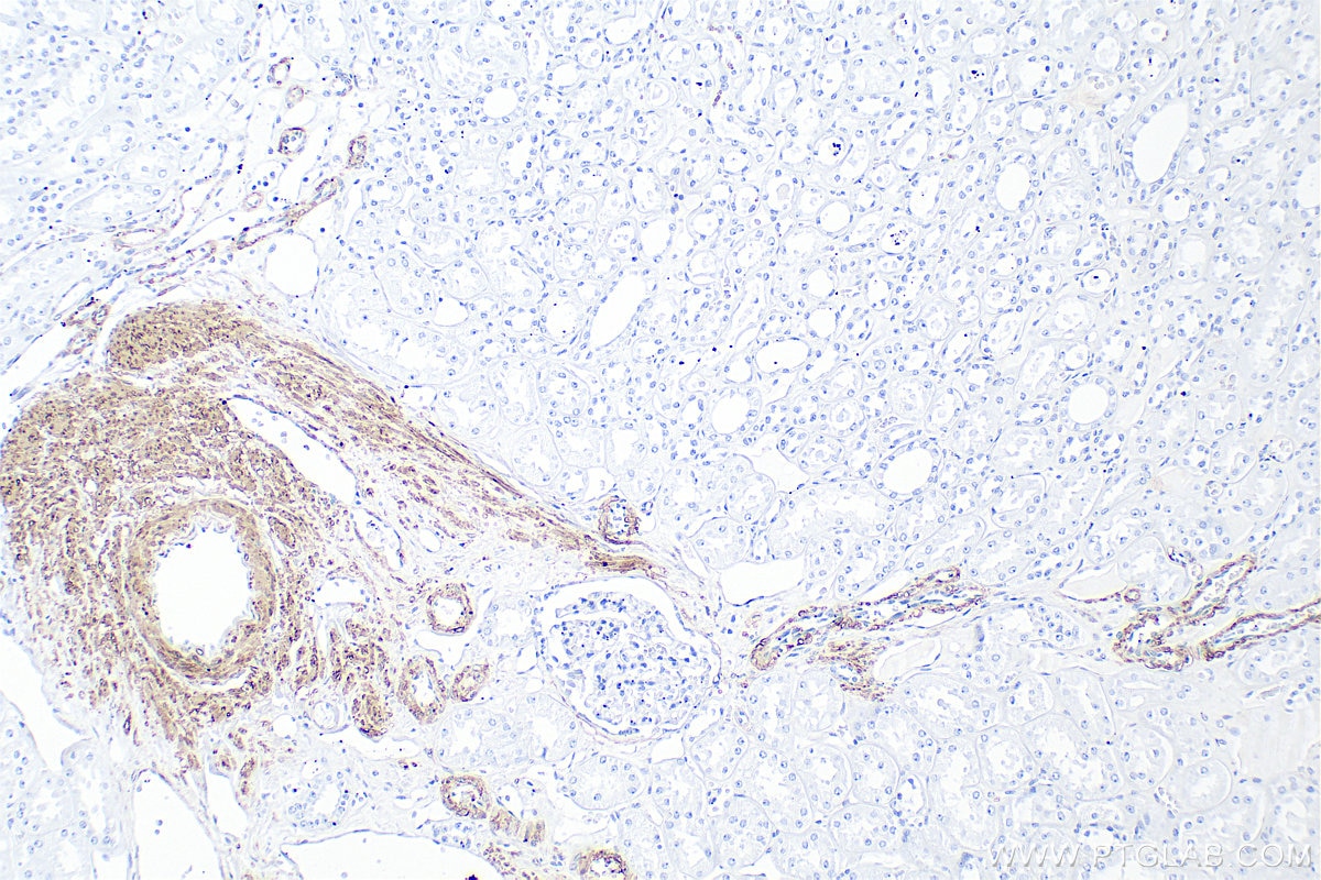 Immunohistochemistry (IHC) staining of human kidney tissue using Multi-rAb® TAGLN Multi-Recombinant antibody (RMX00045)