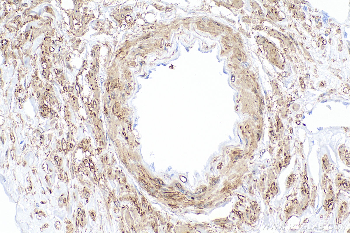 Immunohistochemistry (IHC) staining of human kidney tissue using Multi-rAb® TAGLN Multi-Recombinant antibody (RMX00045)