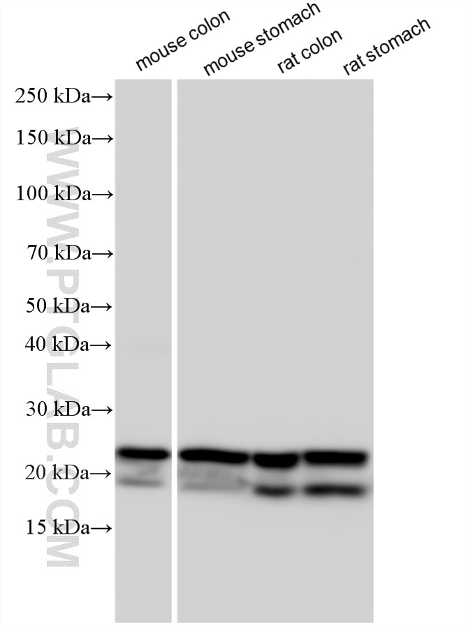 Western Blot (WB) analysis of various lysates using Multi-rAb® TAGLN Multi-Recombinant antibody (RMX00045)