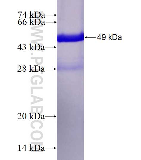 TAGLN fusion protein Ag0764 SDS-PAGE