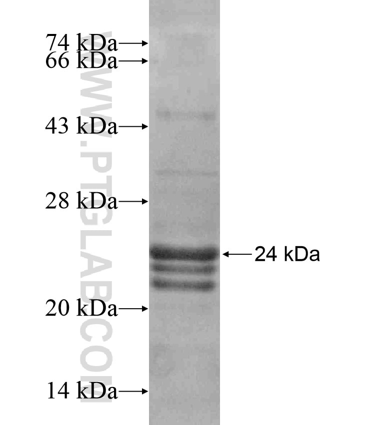 TAGLN fusion protein Ag18031 SDS-PAGE