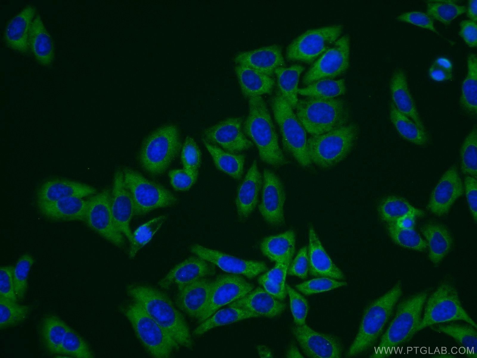 Immunofluorescence (IF) / fluorescent staining of HepG2 cells using Transgelin 2 Polyclonal antibody (10234-2-AP)