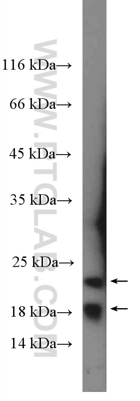 Western Blot (WB) analysis of T-47D cells using Transgelin 2 Polyclonal antibody (10234-2-AP)