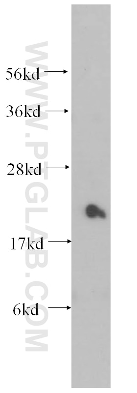 Western Blot (WB) analysis of HEK-293 cells using Transgelin 2 Polyclonal antibody (10234-2-AP)