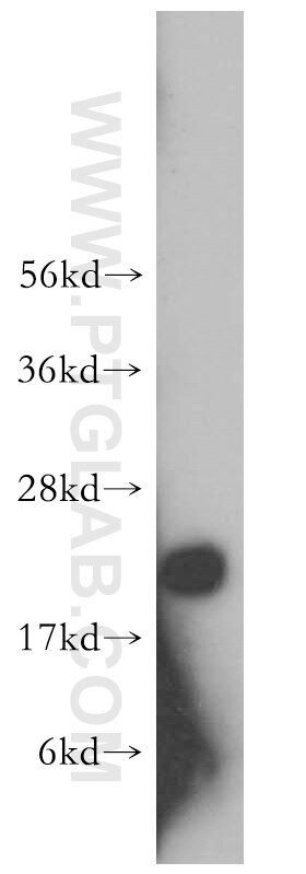 Western Blot (WB) analysis of human heart tissue using Transgelin 2 Polyclonal antibody (10234-2-AP)