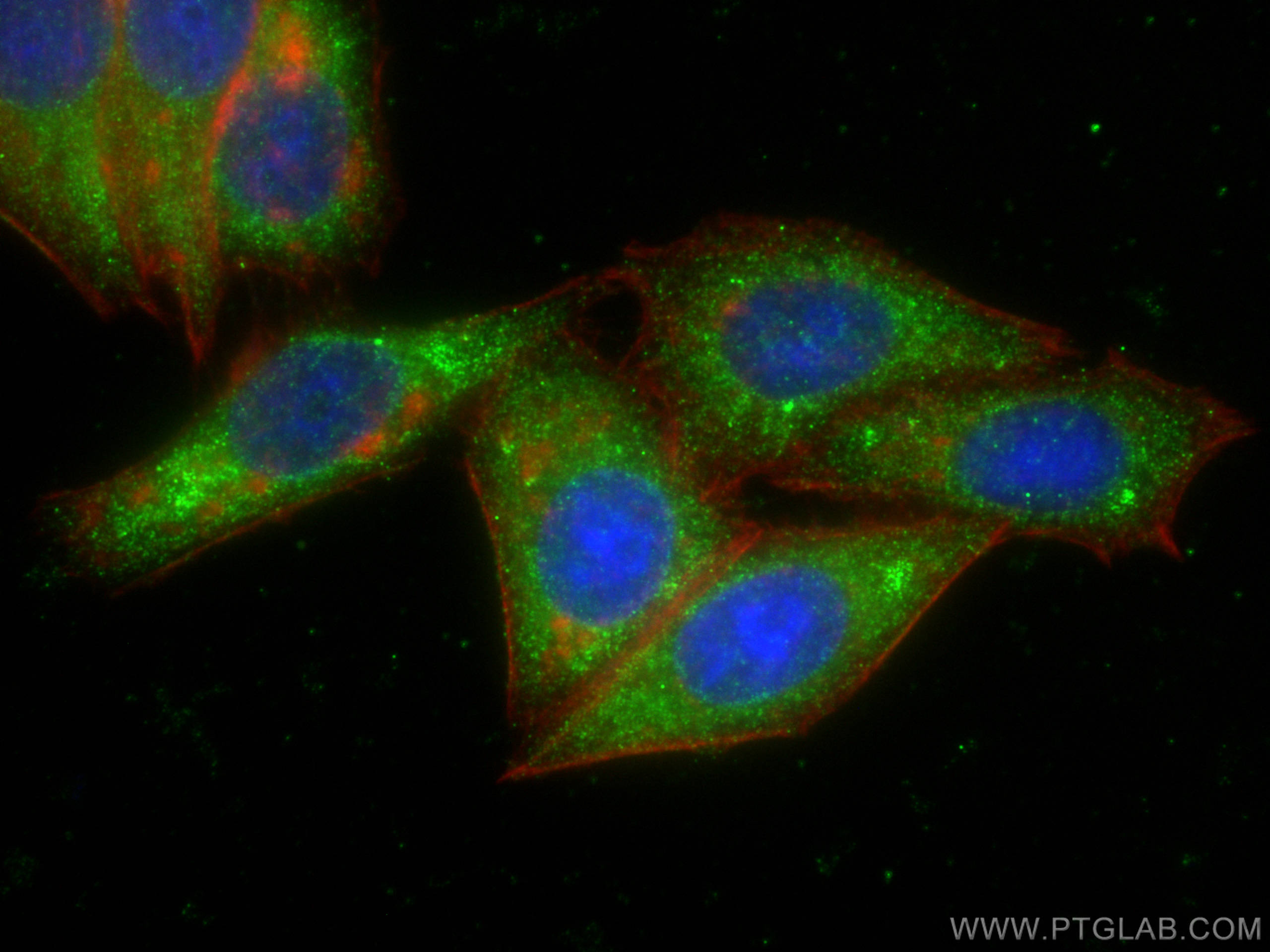 Immunofluorescence (IF) / fluorescent staining of HepG2 cells using Transgelin 2 Monoclonal antibody (60044-1-Ig)