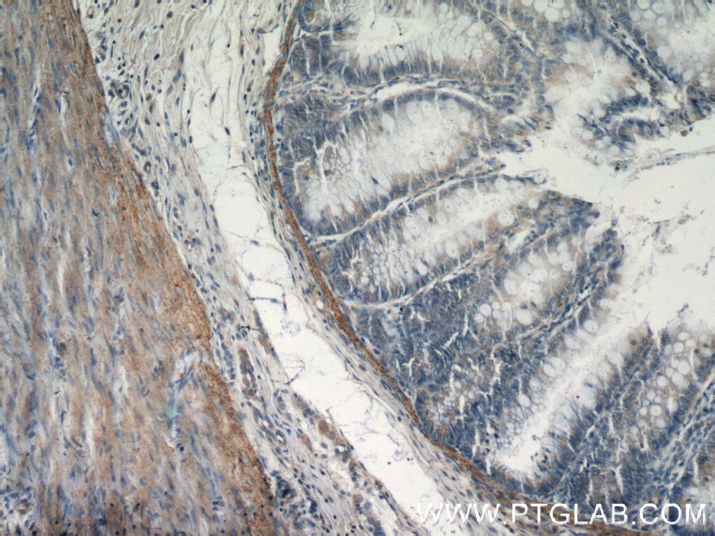 Immunohistochemistry (IHC) staining of human colon tissue using Transgelin 2 Monoclonal antibody (60044-1-Ig)