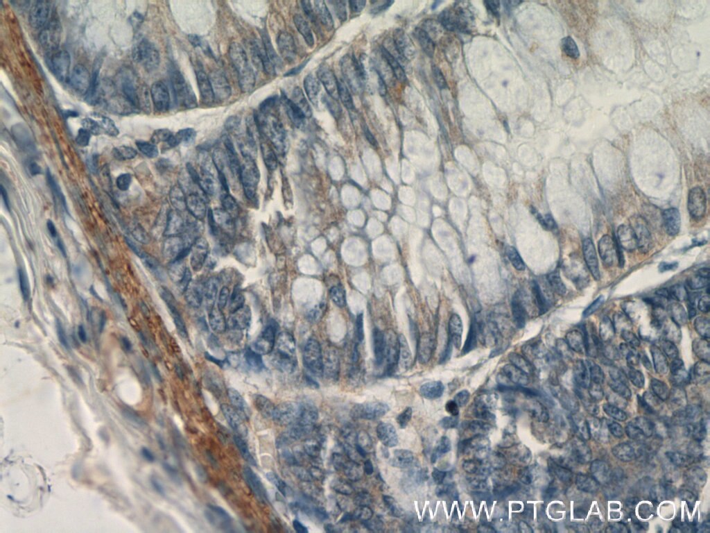 IHC staining of human colon using 60044-1-Ig