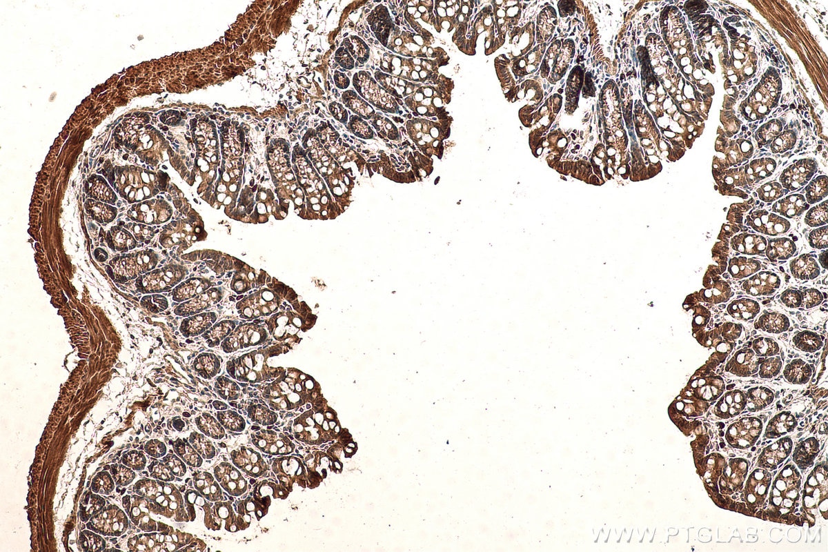 IHC staining of mouse colon using 60044-1-Ig