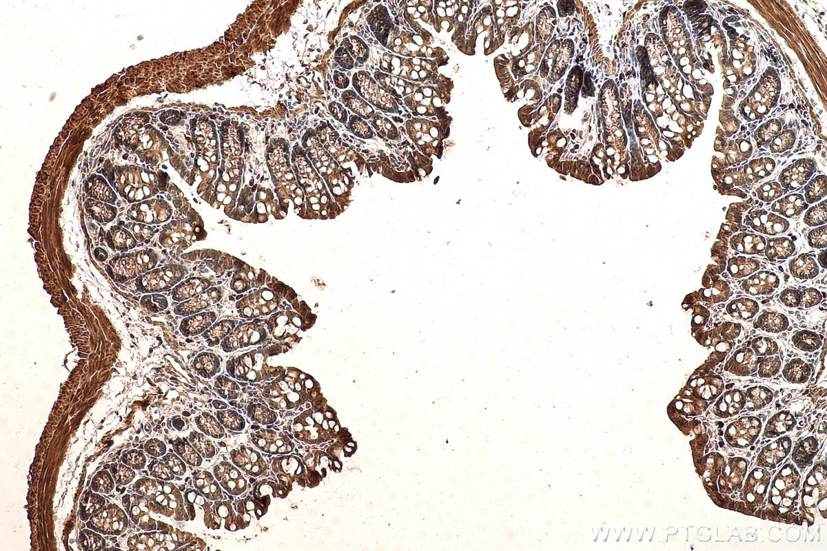 Immunohistochemistry (IHC) staining of mouse colon tissue using Transgelin 2 Monoclonal antibody (60044-1-Ig)