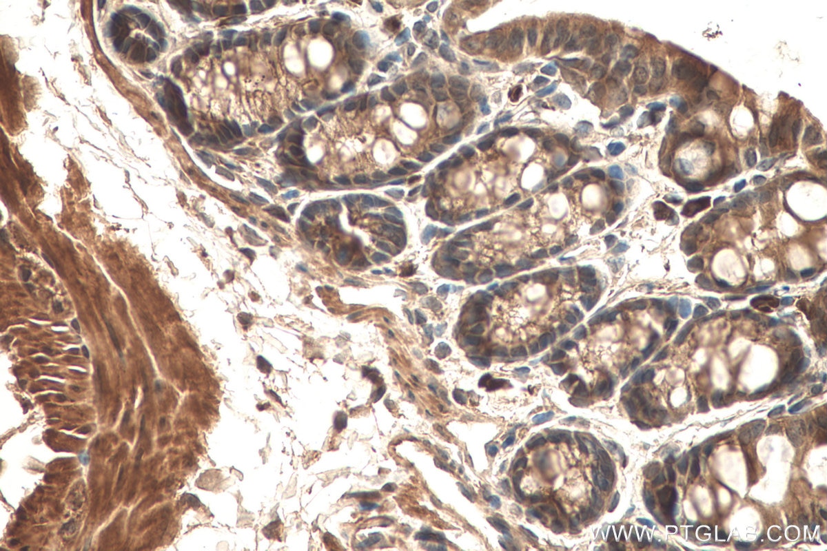 Immunohistochemistry (IHC) staining of mouse colon tissue using Transgelin 2 Monoclonal antibody (60044-1-Ig)
