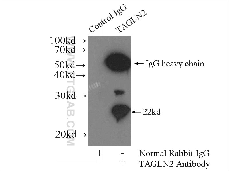 Immunoprecipitation (IP) experiment of HEK-293 cells using Transgelin 2 Monoclonal antibody (60044-1-Ig)