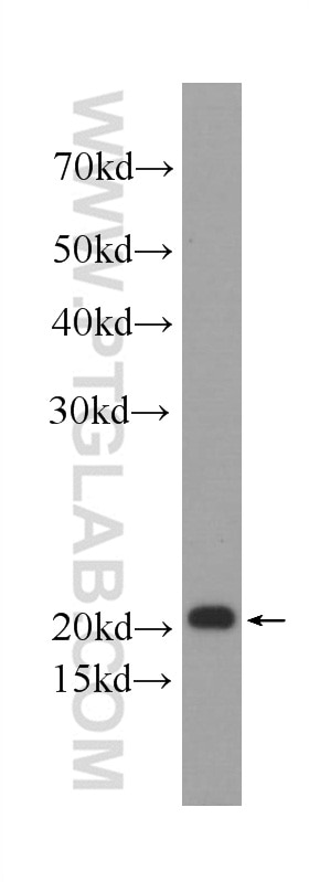 Western Blot (WB) analysis of HEK-293 cells using Transgelin 2 Monoclonal antibody (60044-1-Ig)