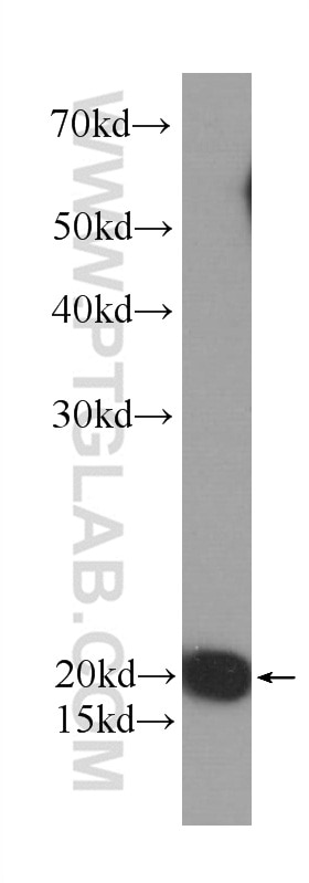 WB analysis of MCF-7 using 60044-1-Ig