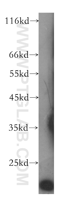 Western Blot (WB) analysis of A549 cells using Transgelin 2 Monoclonal antibody (60044-1-Ig)