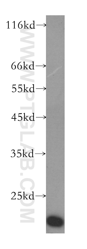 Transgelin 2