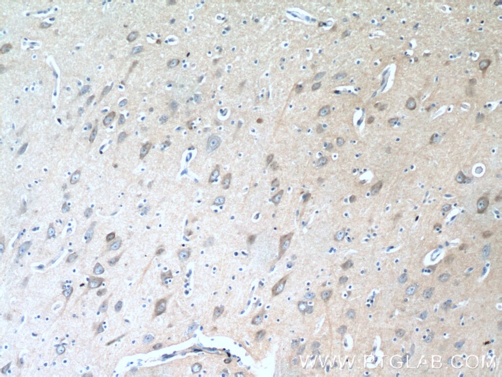 Immunohistochemistry (IHC) staining of human brain tissue using TAGLN3 Polyclonal antibody (12246-1-AP)