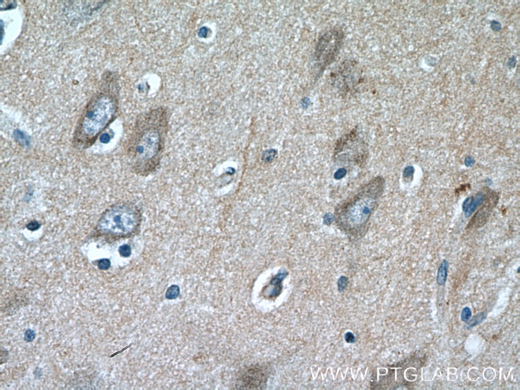 Immunohistochemistry (IHC) staining of human brain tissue using TAGLN3 Polyclonal antibody (12246-1-AP)