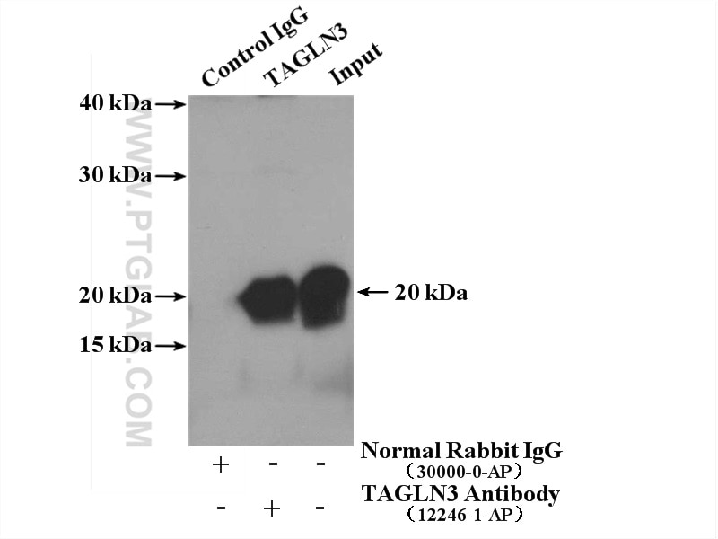 Immunoprecipitation (IP) experiment of mouse brain tissue using TAGLN3 Polyclonal antibody (12246-1-AP)