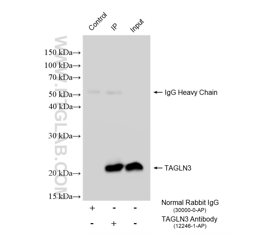 Immunoprecipitation (IP) experiment of rat brain tissue using TAGLN3 Polyclonal antibody (12246-1-AP)